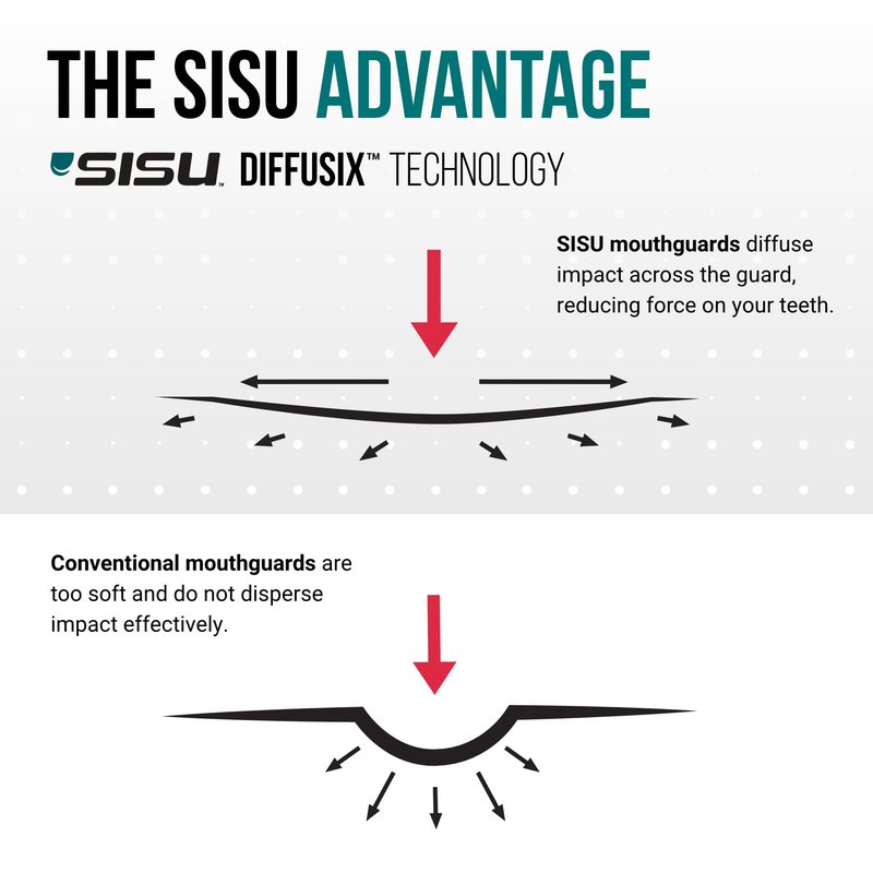 SISU Aero Small Mouthguard, Forest Green - 30% Stronger Protection for Lacrosse, Football, Hockey, Roller Derby, Team Sports - Remoldable Up to 20 Times - Ultra Slim - Non Toxic