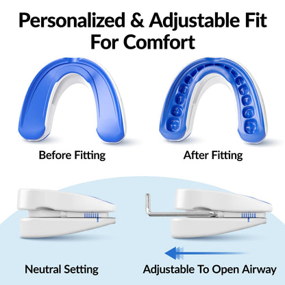 VitalSleep Anti-Snoring Mouthpiece, Comfortable & Adjustable Snore Guard, Quiets Snoring, USA Made, BPA Free & FDA Cleared Anti-Snore Device – Men’s Size