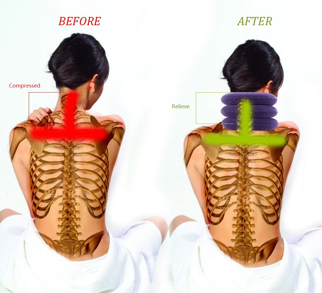 Cervical Neck Traction Device Inflatable Neck Stretcher, Easy to Use for Chronic Neck and Shoulder Pain Relief Traction Spine Alignment, Neck Cervical Brace，Purple