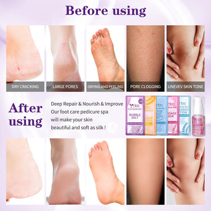 Pedicure Kit Foot Soak Set: Bubble Salt, Sugar Scrub, Massage Mask, Massage Lotion in a Box, 4 Step Foot Spa Kit for Dry Feet,Tired Feet（3 Set Tropical Fruit)