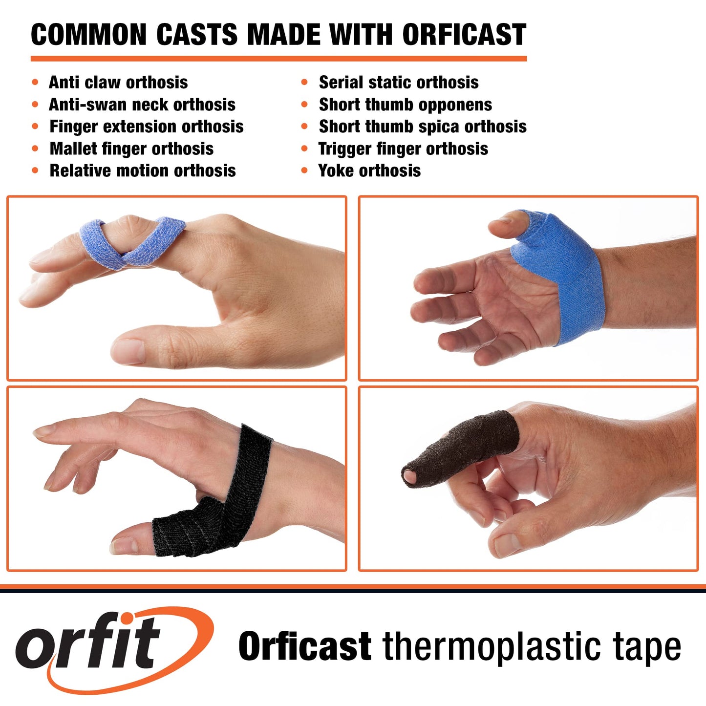 Orficast by Orfit Easy-Form Splinting Material Heat-Activated Thermoplastic Tape For Trigger Finger, Thumb, Arthritis Pain Relief, Hand Support 1” x 9’, Blue, One Roll