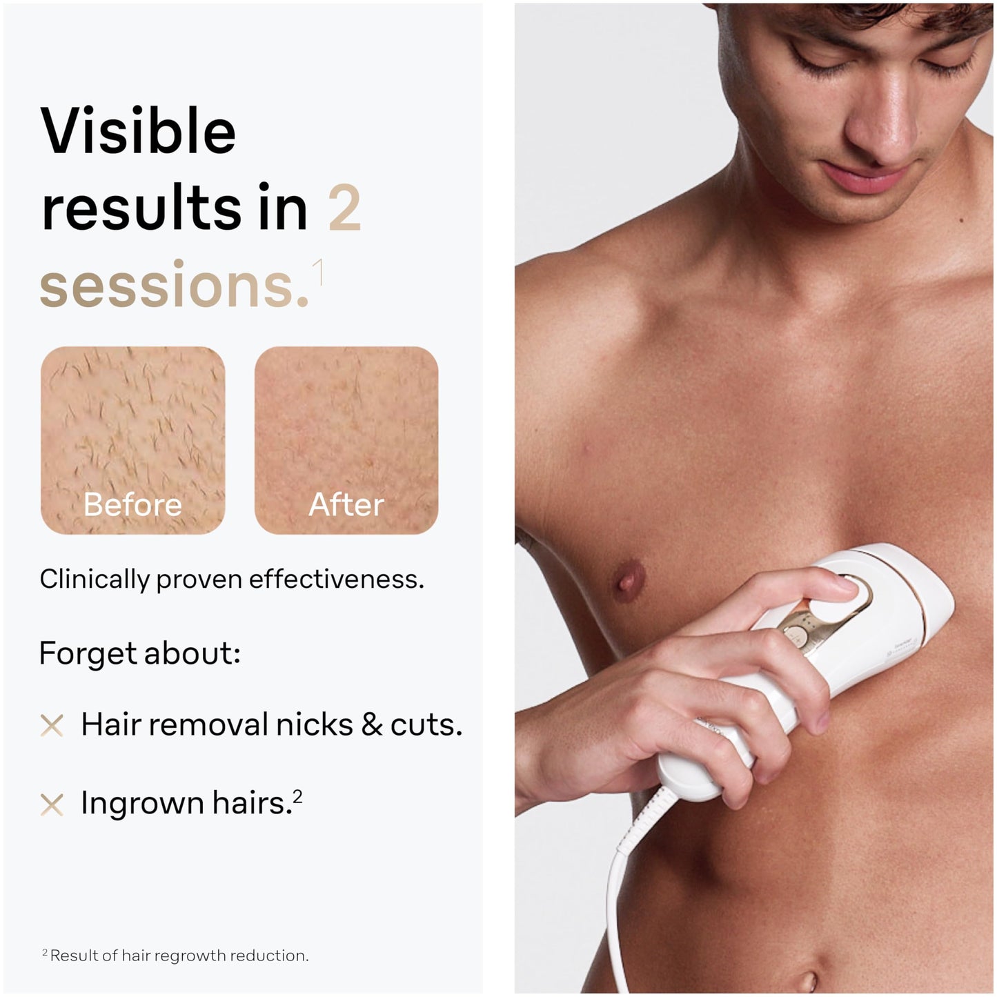 Braun IPL at Home Laser Hair Removal for Women and Men, Silk Expert Pro 5 PL5137 with Venus Swirl Razor, Permanent Visible Hair Reduction in Hair Regrowth for Body & Face, Corded, PL5137
