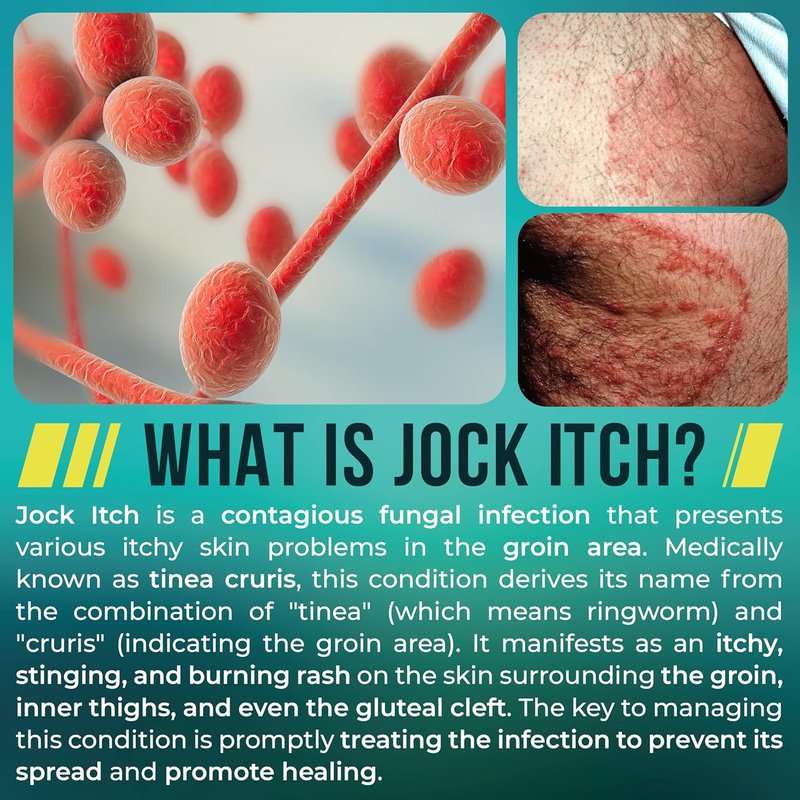 Jock Itch Spray - Antifungal Relief for Itchy Skin | Fast Absorption & Deep Penetration | Soothes Groin & Inner Thighs