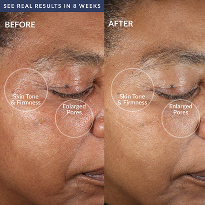 PMD Beauty Clean Pro OB - Smart Facial Cleansing Device